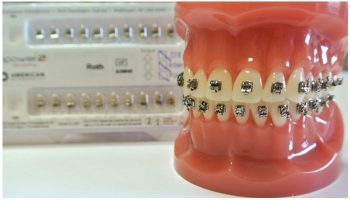 Брекет-система Mini Master США